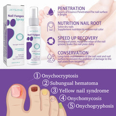 FUNGAL NAIL TREATMENT FOR TOENAILS EXTRA STRONG,100ML SPRAY FOR NAILS