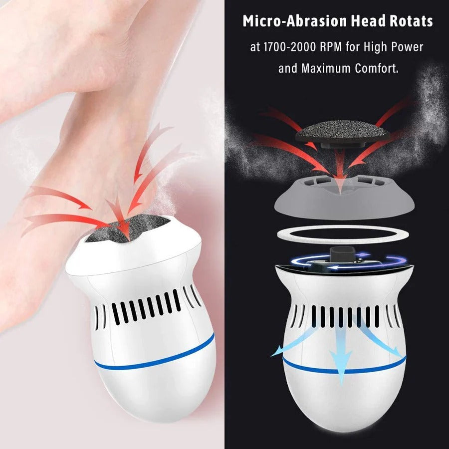 ELECTRIC CALLUS REMOVER
